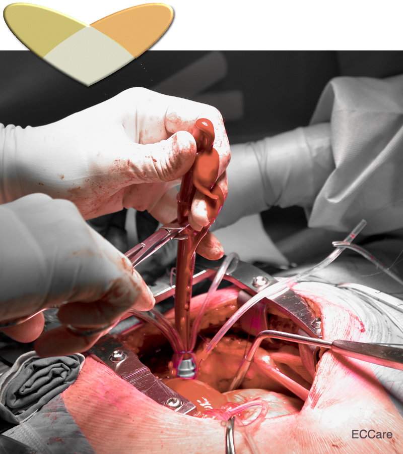 heart_ecc